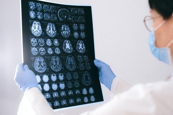 are dyslexics right or left brained