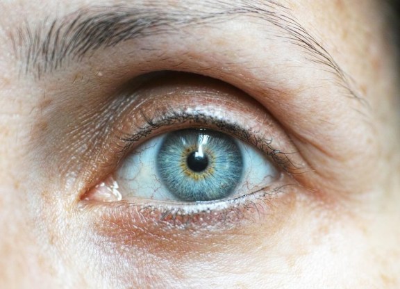 Does dyslexia affect eyesight?