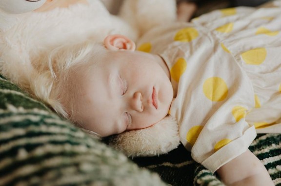 what is the most common childhood disability